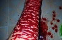 Hình ảnh rạch tay thật chảy máu bằng lưỡi lam 6