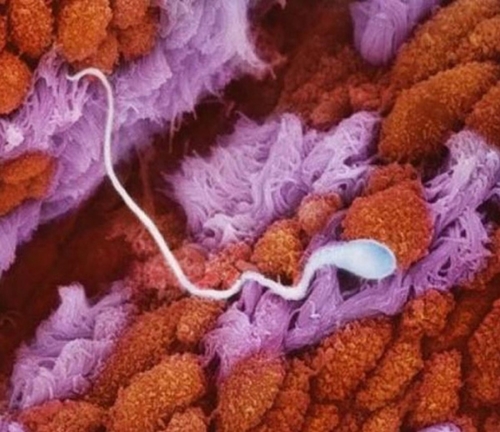 Sự phát triển của thai nhi từ khi thụ tinh đến lúc chào đời 1