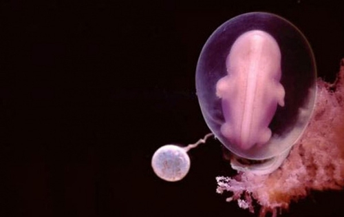 Sự phát triển của thai nhi từ khi thụ tinh đến lúc chào đời 10
