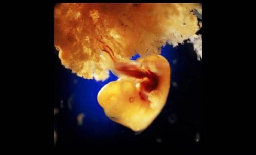 Sự phát triển của thai nhi từ khi thụ tinh đến lúc chào đời 12