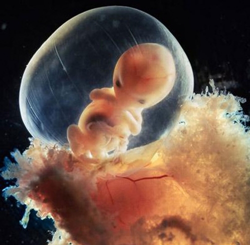 Sự phát triển của thai nhi từ khi thụ tinh đến lúc chào đời 13