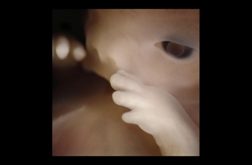 Sự phát triển của thai nhi từ khi thụ tinh đến lúc chào đời 14