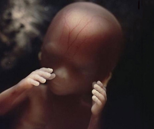 Sự phát triển của thai nhi từ khi thụ tinh đến lúc chào đời 16