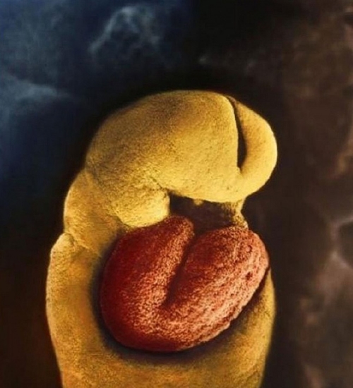 Sự phát triển của thai nhi từ khi thụ tinh đến lúc chào đời 8